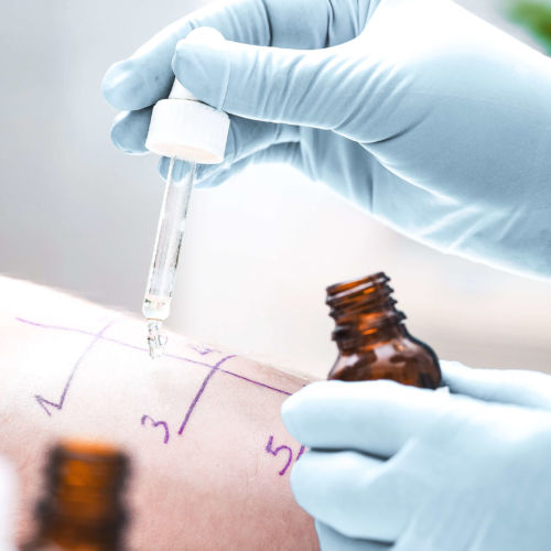 Allergiebehandlung in Hausarzt Dr. med. Dost Mohammad Landshut, Medizinisches Versorgungszentrum (MVZ) Vilsbiburg und Privatpraxis in Erding